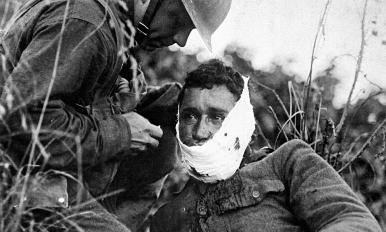 داستان تولد جراحی پلاستیک از میان ویرانه‌های جنگ جهانی اول