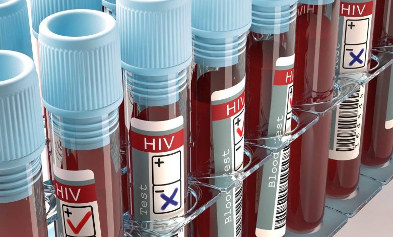 عفونت HIV بیمار ۶۶ ساله پس از پیوند سلول‌های بنیادی درمان شد
