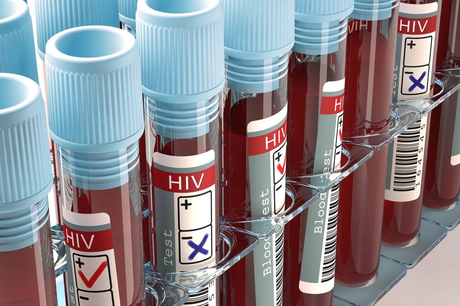 عفونت HIV بیمار ۶۶ ساله پس از پیوند سلول‌های بنیادی درمان شد