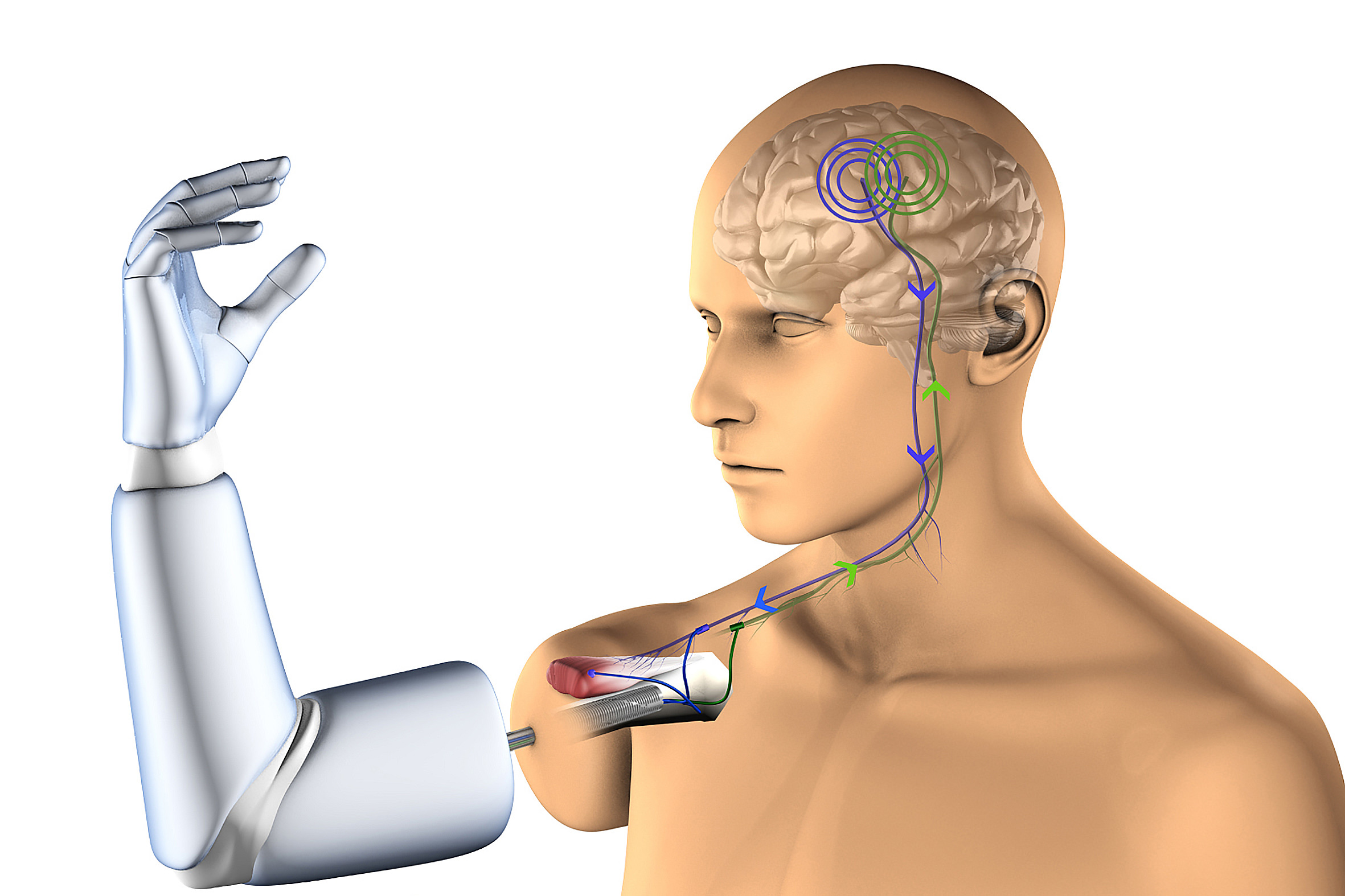 مرد نیمه‌معلول به‌کمک بازوی رباتیک متصل به ذهن خود توانست غذا بخورد