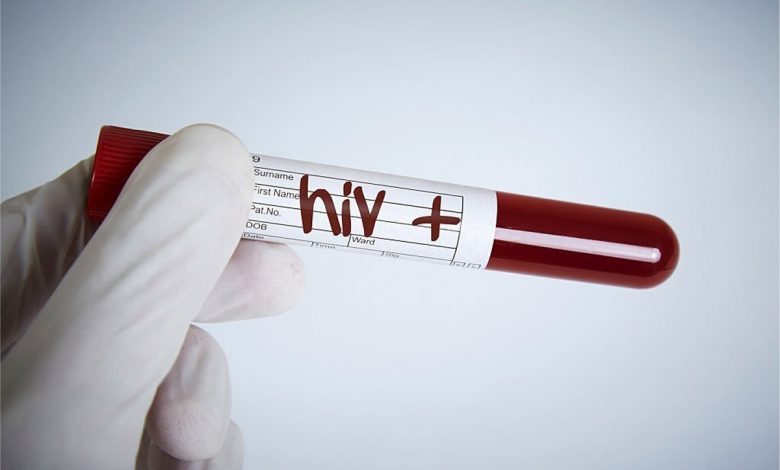 هشدار سازمان ملل: آمار ابتلا به HIV در سراسر دنیا بسیار نگران‌کننده است