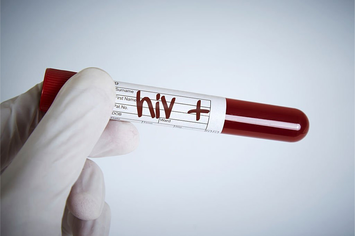 هشدار سازمان ملل: آمار ابتلا به HIV در سراسر دنیا بسیار نگران‌کننده است