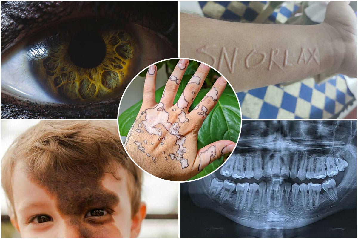تصاویر منحصربهفرد از ژنتیکهای کمیاب و متفاوت