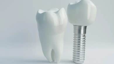 اطلاعات درباره ایمپلنت دندان