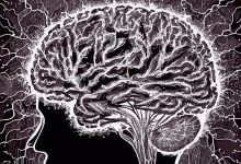 اختلال عصبی عملکردی چیست، چه علائمی دارد و چگونه درمان می‌شود؟
