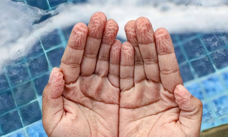 انگشتها پس از خیسشدن در آب همواره به یک شکل چروک میشوند