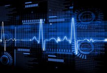 هوش مصنوعی و تحول در تشخیص بیماری‌های قلبی: نوآوری‌های جدید در تحلیل نوار قلب (ECG)