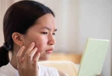 رازهای پنهان مراقبت از پوست: ۵ عادت ساده برای پیشگیری و درمان جوش