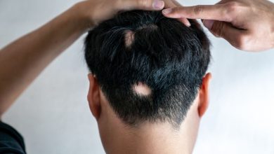 آیا در حال کچل شدن هستید؟ از این هوش مصنوعی بپرسید