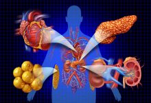 بیشتر مردم درمعرض ابتلا به یک بیماری مهم هستند؛ اما حتی نامش را هم نشنیده‌اند