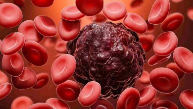 روش جدید نوردرمانی در نیم ساعت، ۹۰ درصد از سلولهای سرطانی را از بین میبرد