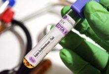 کشف قوی‌ترین شواهد از نقش ویروس اپشتین بار در بروز بیماری لوپوس