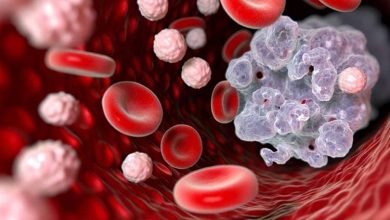 ۴ نشانه عجیب سرطان که هرگز نباید نادیده بگیرید