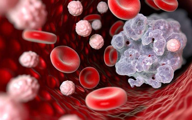 ۴ نشانه عجیب سرطان که هرگز نباید نادیده بگیرید