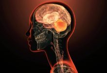 برای نخستین‌بار یک ژن واحد به‌تنهایی عامل بیماری روانی شناخته شد