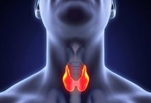 درمان سرطان تیروئید: از تشخیص زودهنگام تا رویکردهای کم‌تهاجمی نوین