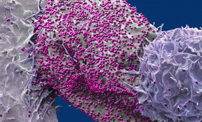 درمان غیرمنتظره برای ایدز؛ هفتمین بیمار رهاشده از HIV پزشکان را غافلگیر کرد