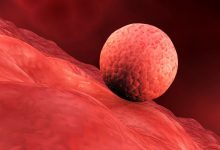 دستاورد انقلابی در درمان ناباروری؛ ساخت بافت رحم در محیط آزمایشگاه امکان‌پذیر شد