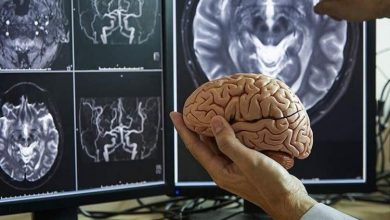 مغز انسان در چهار مقطع کلیدی عمر، بازسازمان‌دهی می‌شود