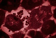 پیوند عضو مرگبار؛ اهداکننده کلیه ویروس هاری را به گیرنده منتقل کرد و جان او را گرفت