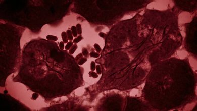 پیوند عضو مرگبار؛ اهداکننده کلیه ویروس هاری را به گیرنده منتقل کرد و جان او را گرفت