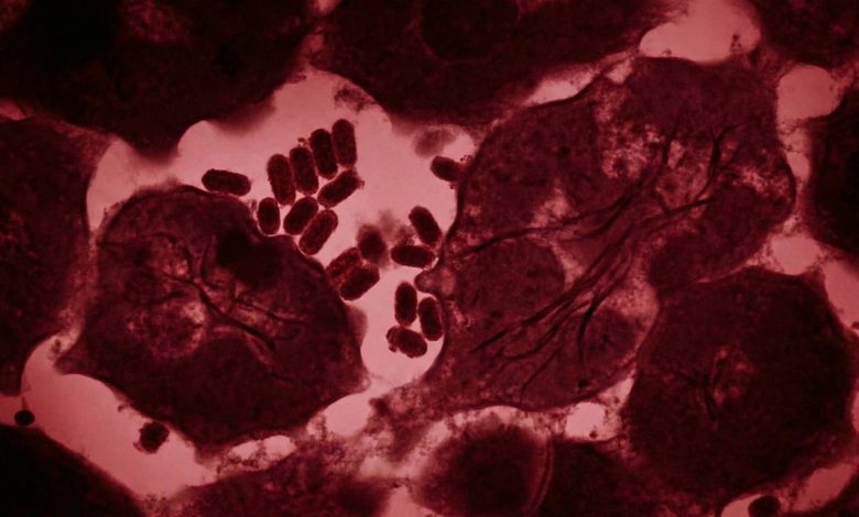 پیوند عضو مرگبار؛ اهداکننده کلیه ویروس هاری را به گیرنده منتقل کرد و جان او را گرفت