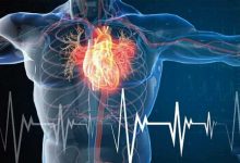 چهار عادت ساده که از حمله قلبی جلوگیری می‌کنند