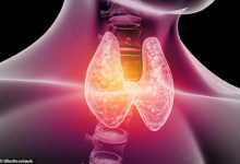 ارتباط پرکاری تیروئید با ویژگی‌های شخصیت تاریک