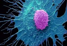 رمز تازه فرار سلول‌های سرطانی