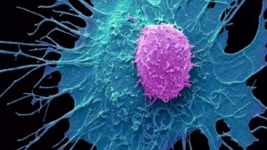 رمز تازه فرار سلول‌های سرطانی