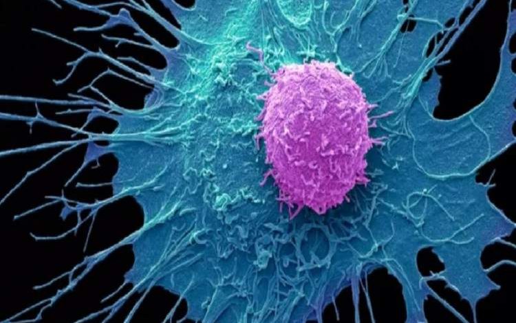 رمز تازه فرار سلول‌های سرطانی